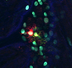 Enteric glial cells within the gut wall, imaged by confocal microscopy