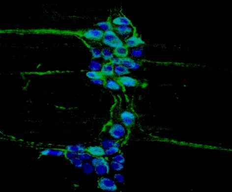 Enteric neuron networks in the gut wall, imaged by confocal microscopy